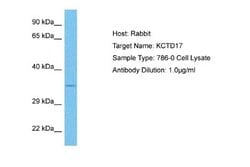 KCTD17 Antibody, Novus Biologicals 100 &mu;L | Buy Online | Novus Biologicals | Fisher Scientific
